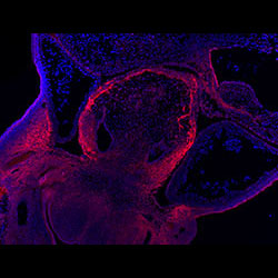 CRABP2 gene expression in a CS16 human embryonic heart